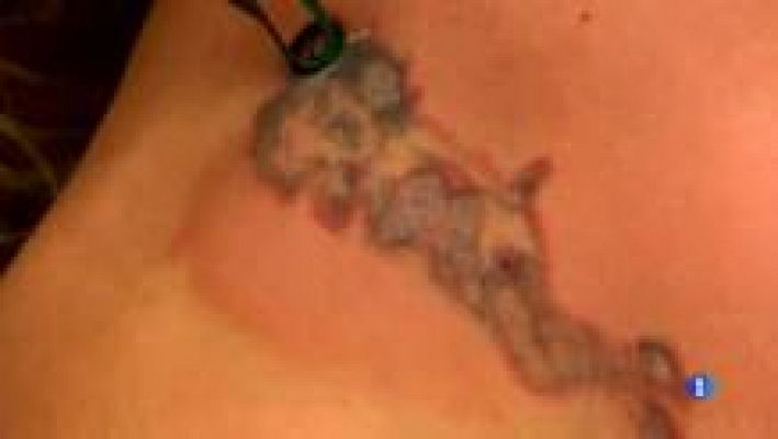 L'Informatiu - En acabar l'estiu...es visita més al dermatòleg