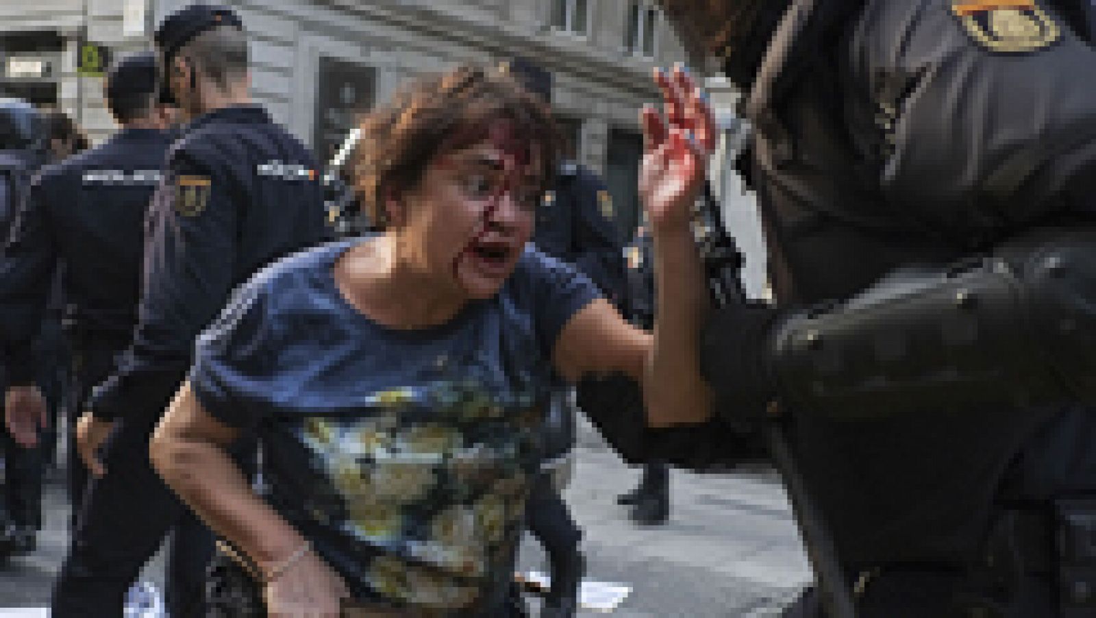 Telediario 1: Incidentes en la concentración de 'Rodea el Congreso' | RTVE Play