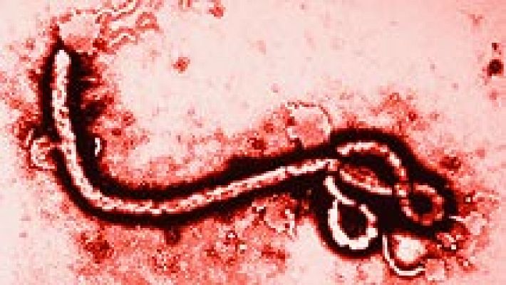 ¿Cómo se contagia el virus del ébola?