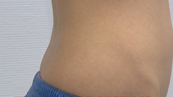 T con T - Embarazos invisibles