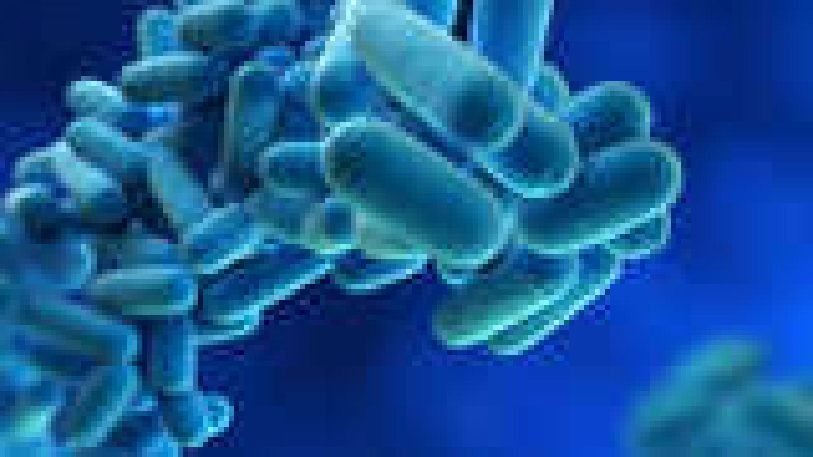 Informe Semanal: Legionela, la bacteria que vuela | RTVE Play