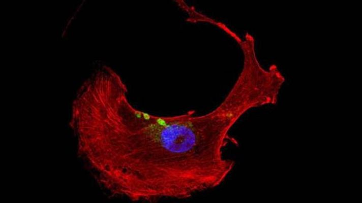 Telediario 1 - Identifican un gen que causa la muerte súbita hereditaria