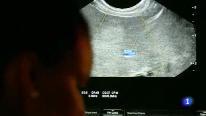 Telenorte - País Vasco - Telenorte País Vasco 2 - 26/11/14