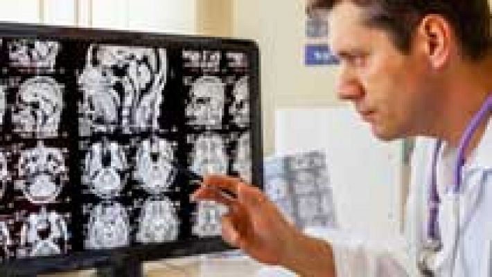 La mañana - Radiografía para un cerebro sano