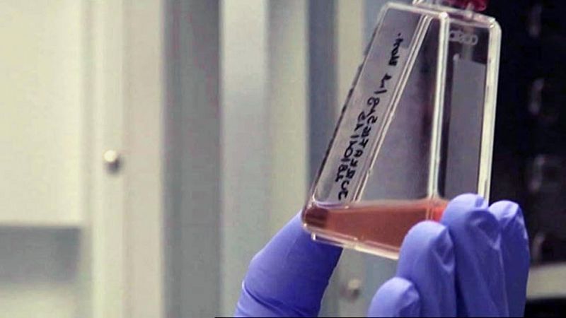 Continúa la investigación en prevención del SIDA en el Instituto de Salud Carlos III 