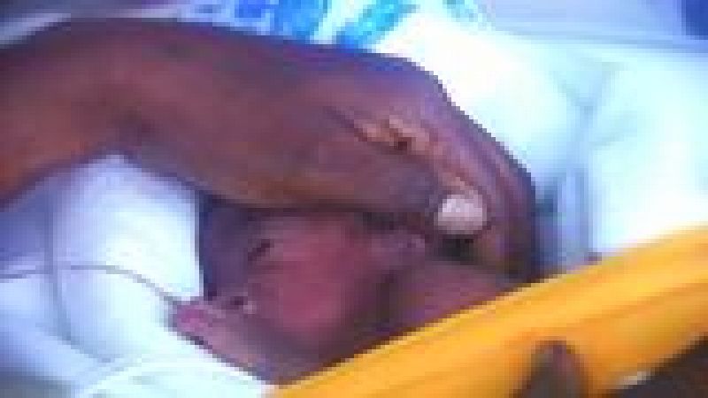 Los cuidados del bebé prematuro: una nueva mirada