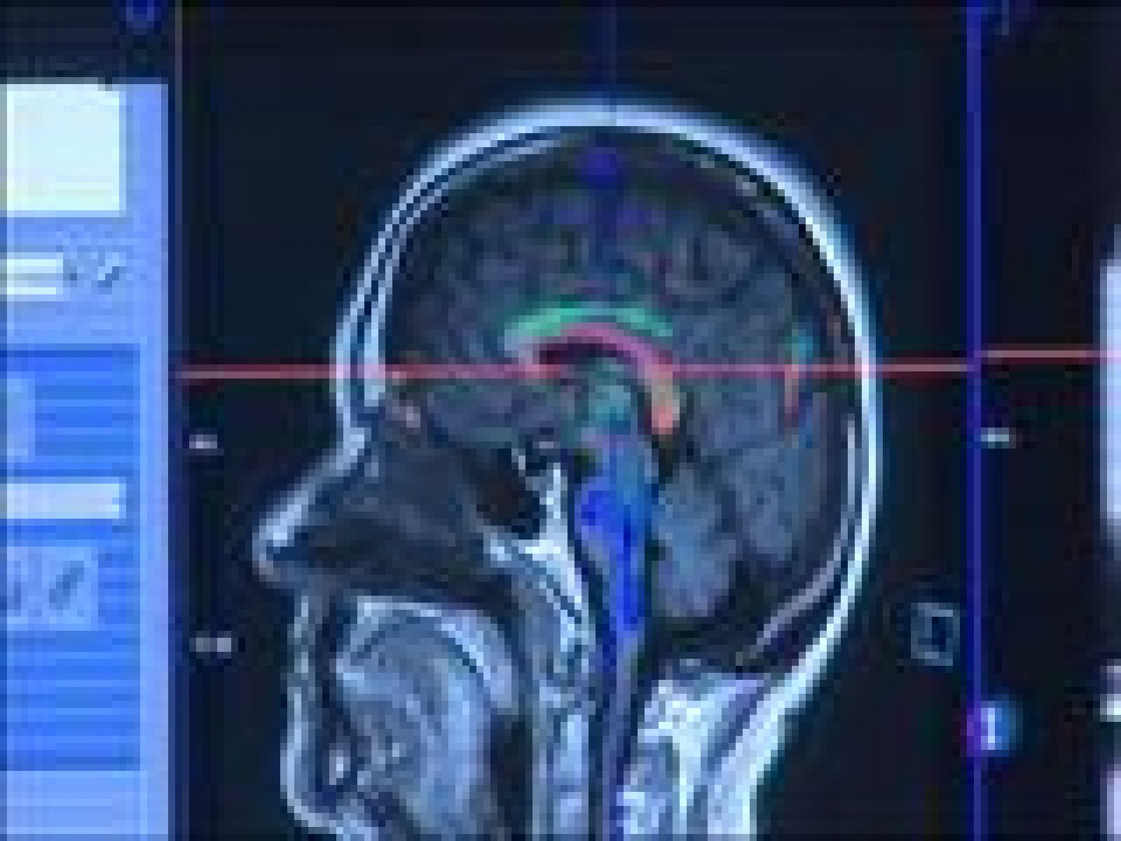 Panorama Regional 2 - 10/02/15 | Ver