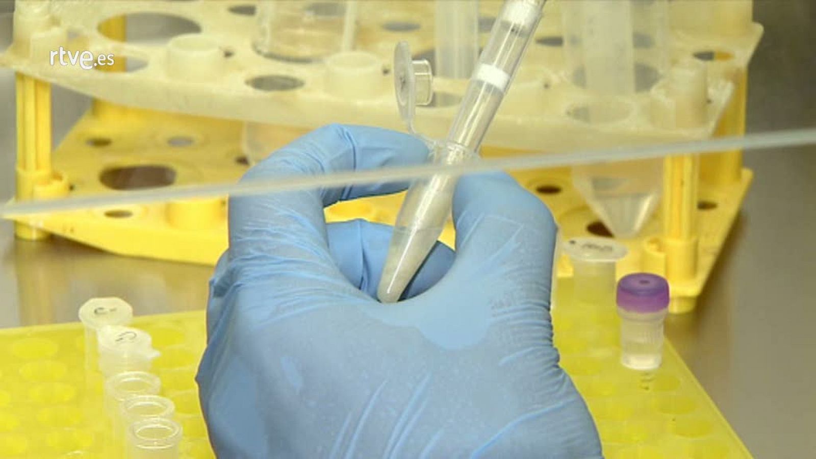 Crean un método para elegir el tratamiento más eficaz contra la hepatitis C