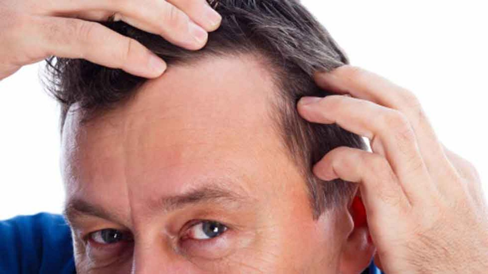 Lo último para la caída del cabello