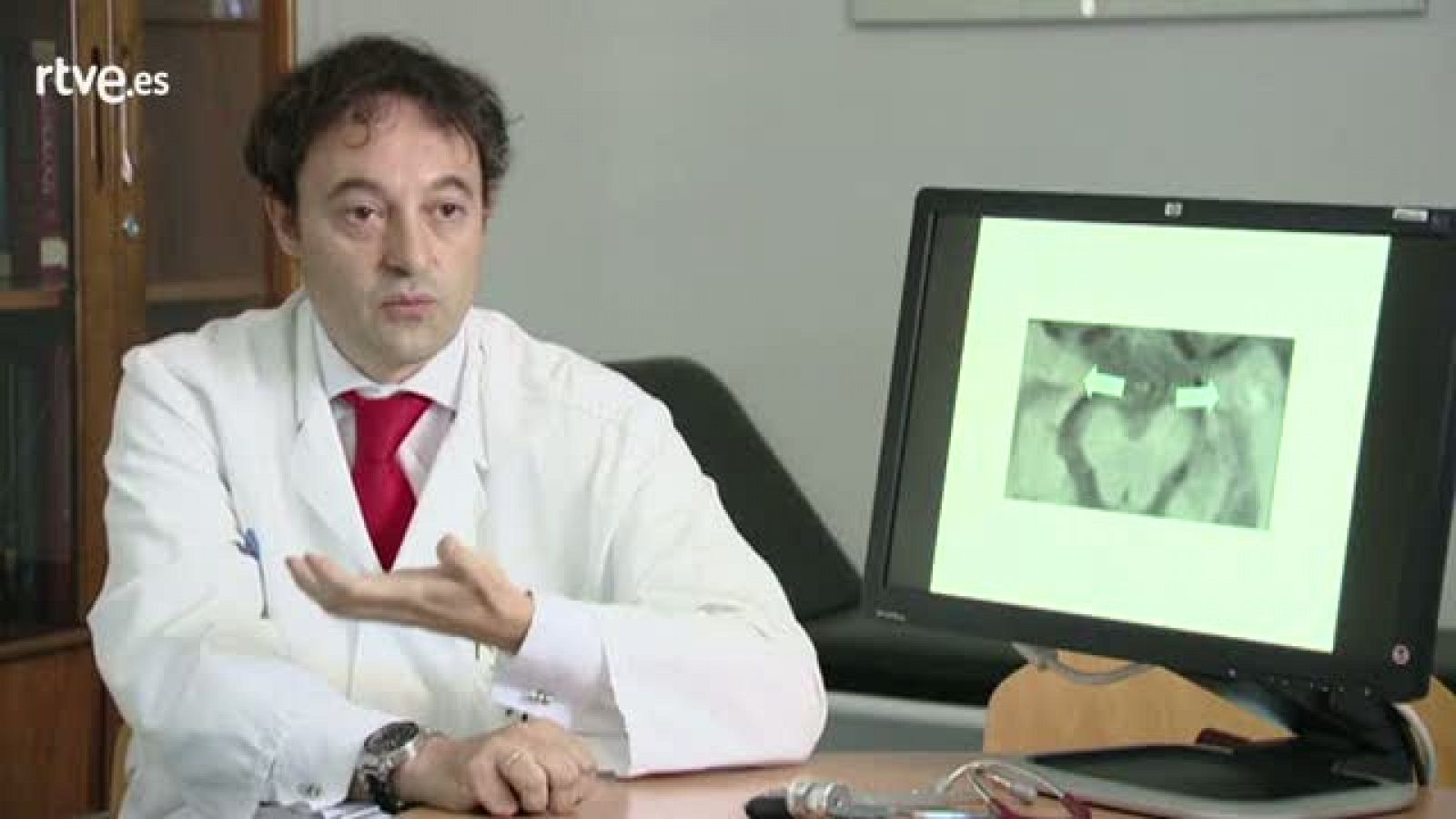 Crónicas - Sensibilidad al trasluz - Dr. Jesús Porta