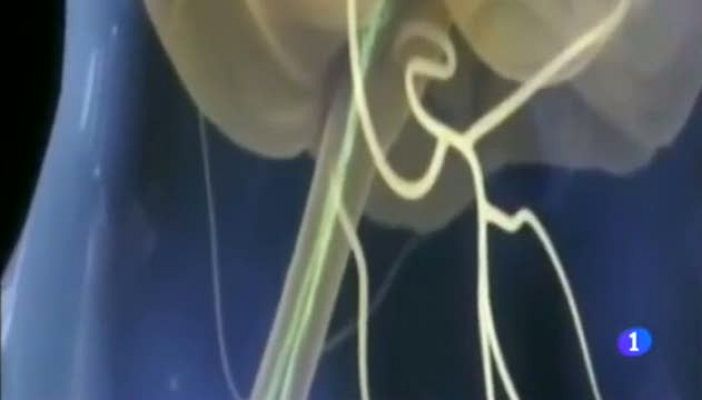 Noticias Aragón - VOLVER A CAMINAR - 18/02/2015