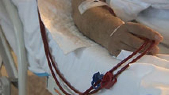 Más de 50.000 españoles padece enfermedad renal crónica