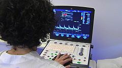Las enfermedades cardiovasculares son la primera causa de muerte en el mundo