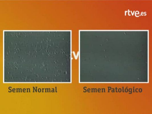 Ciencia y tecnología en Rtve.es - Semen de buena y mala calidad