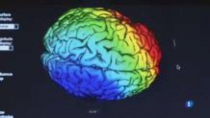 L'Informatiu - Millorar la detecció i el tractament de la migranya