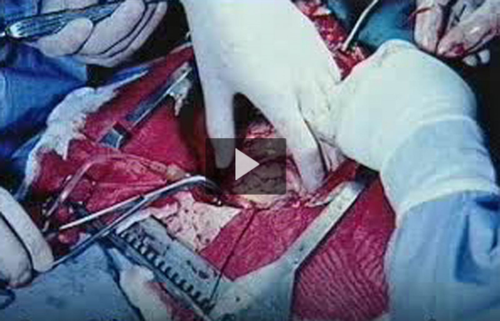 Fotografias impactantes en las cajetillas de tabaco - Ciencia y tecnología en Rtve.es | Ver