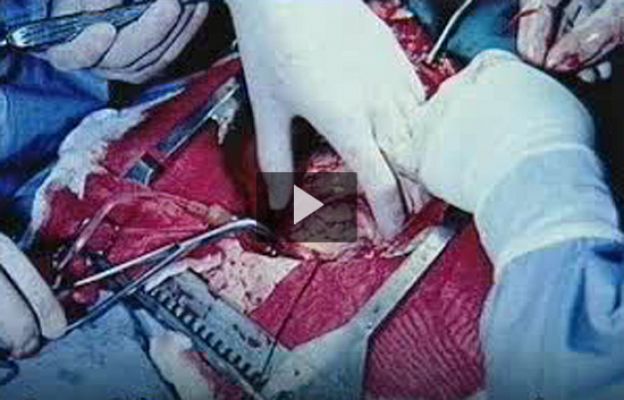 Ciencia y tecnología en Rtve.es - Fumar provoca cáncer