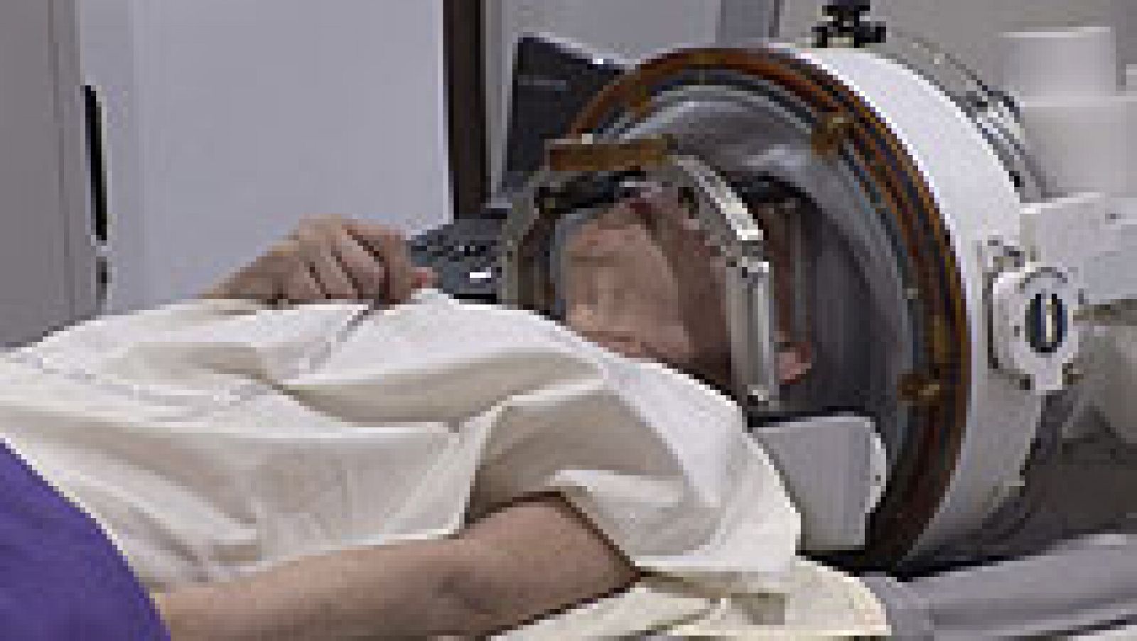 España realiza con éxito la primera operación de cerebro sin abrir el cráneo | Ver