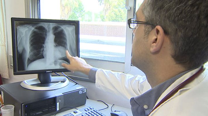 Telediario 1 - 18.000 personas mueren cada año de cáncer de pulmón