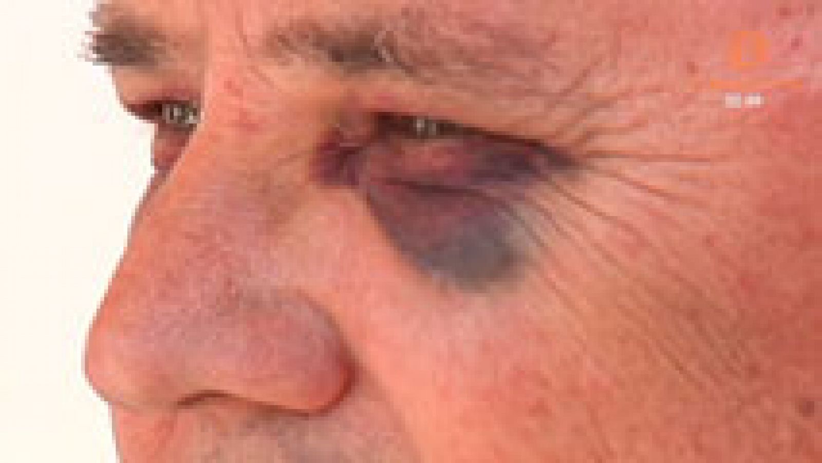 España Directo: Un cliente propina una brutal paliza a un taxista en Sevilla | RTVE Play