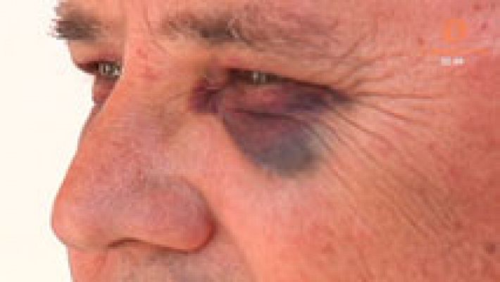 Un cliente propina una brutal paliza a un taxista en Sevilla