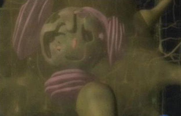 Ciencia y tecnología en Rtve.es - Esquizofrenia, cerebro más pequeño