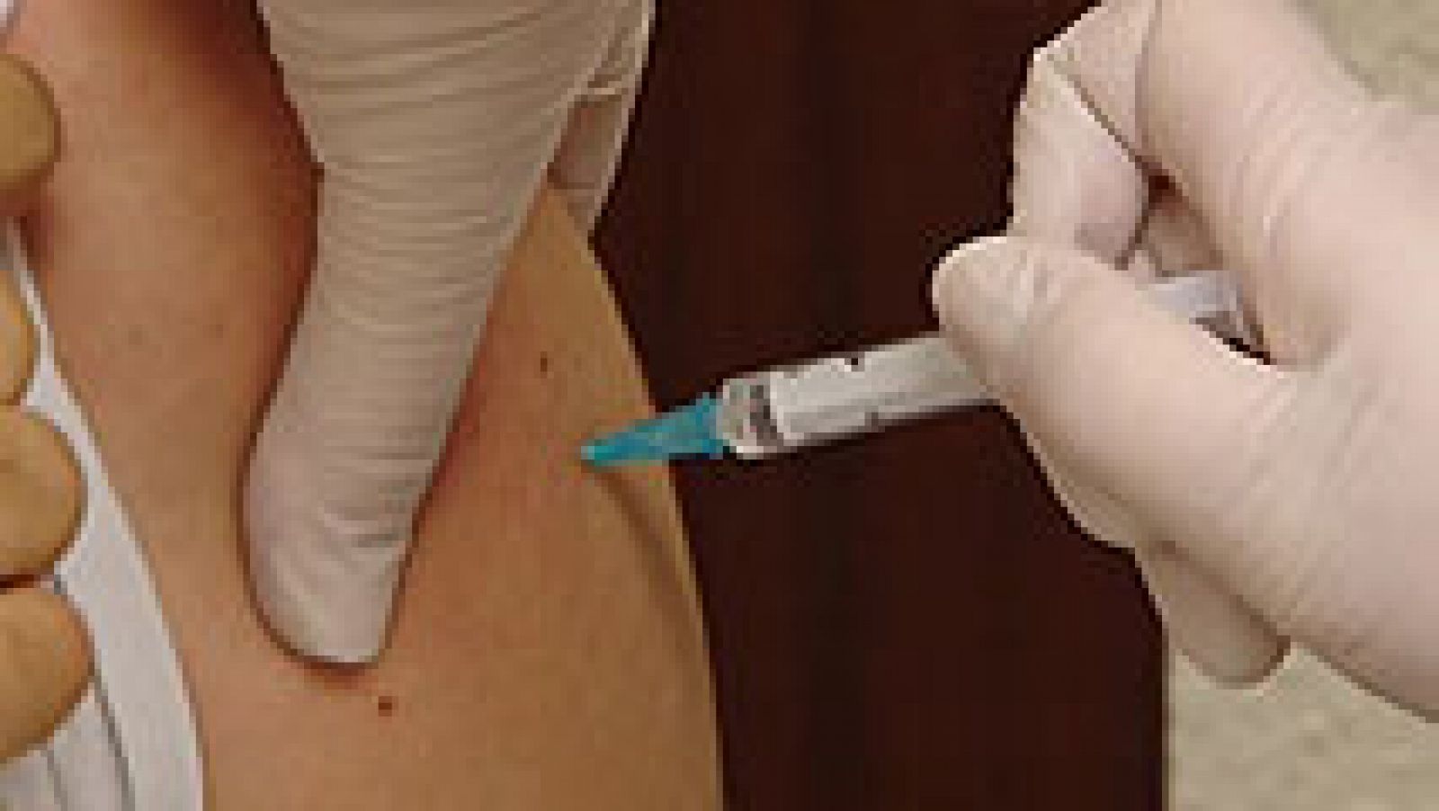 Telediario 1: Sanidad propone incluir la vacuna de varicela para infantil | RTVE Play