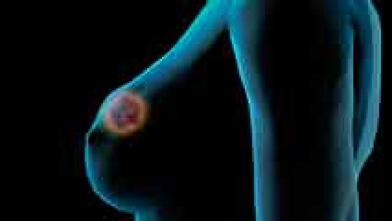 Los consejos de Saber vivir - Salud - 'Bala Mágica': Tratamiento contra el cáncer de mama