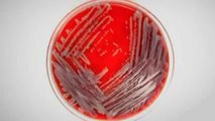 Documentos TV - Una bacteria de pesadilla