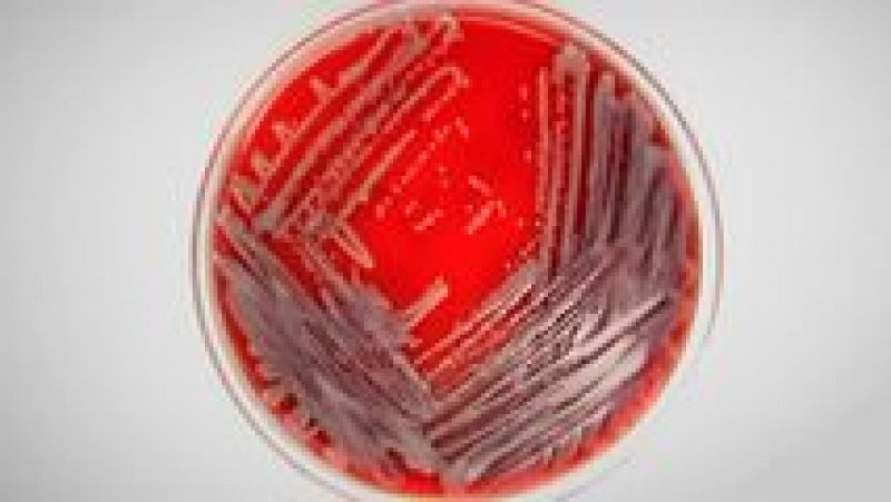 Documentos TV - Una bacteria de pesadilla - ver ahora 