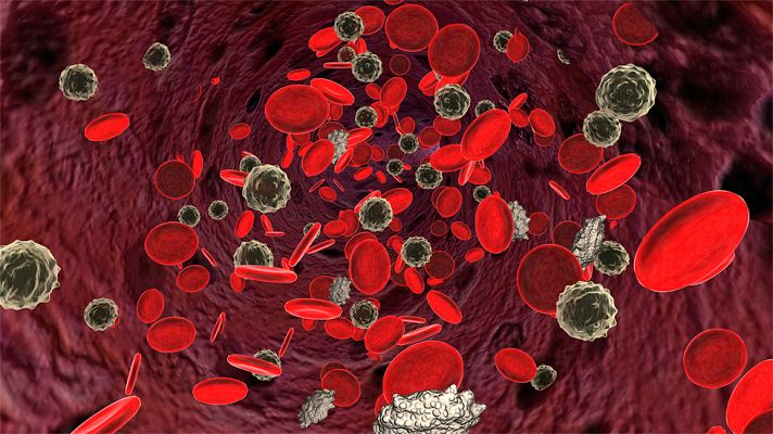 Telediario 1 - Investigadores españoles identifican los genes que mutan para provocar leucemia linfática crónica