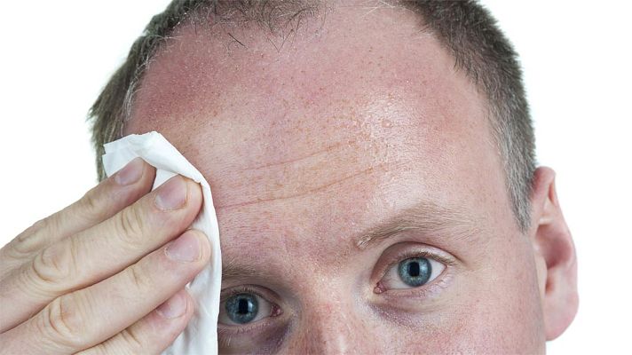 Telediario 1 - Más de un millón de personas sufren en España hiperhidrosis, exceso de sudoración