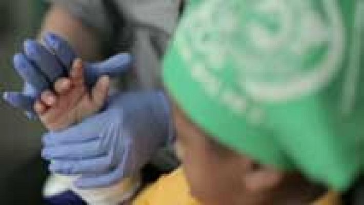 Por primera vez un niño recibe un trasplante de manos