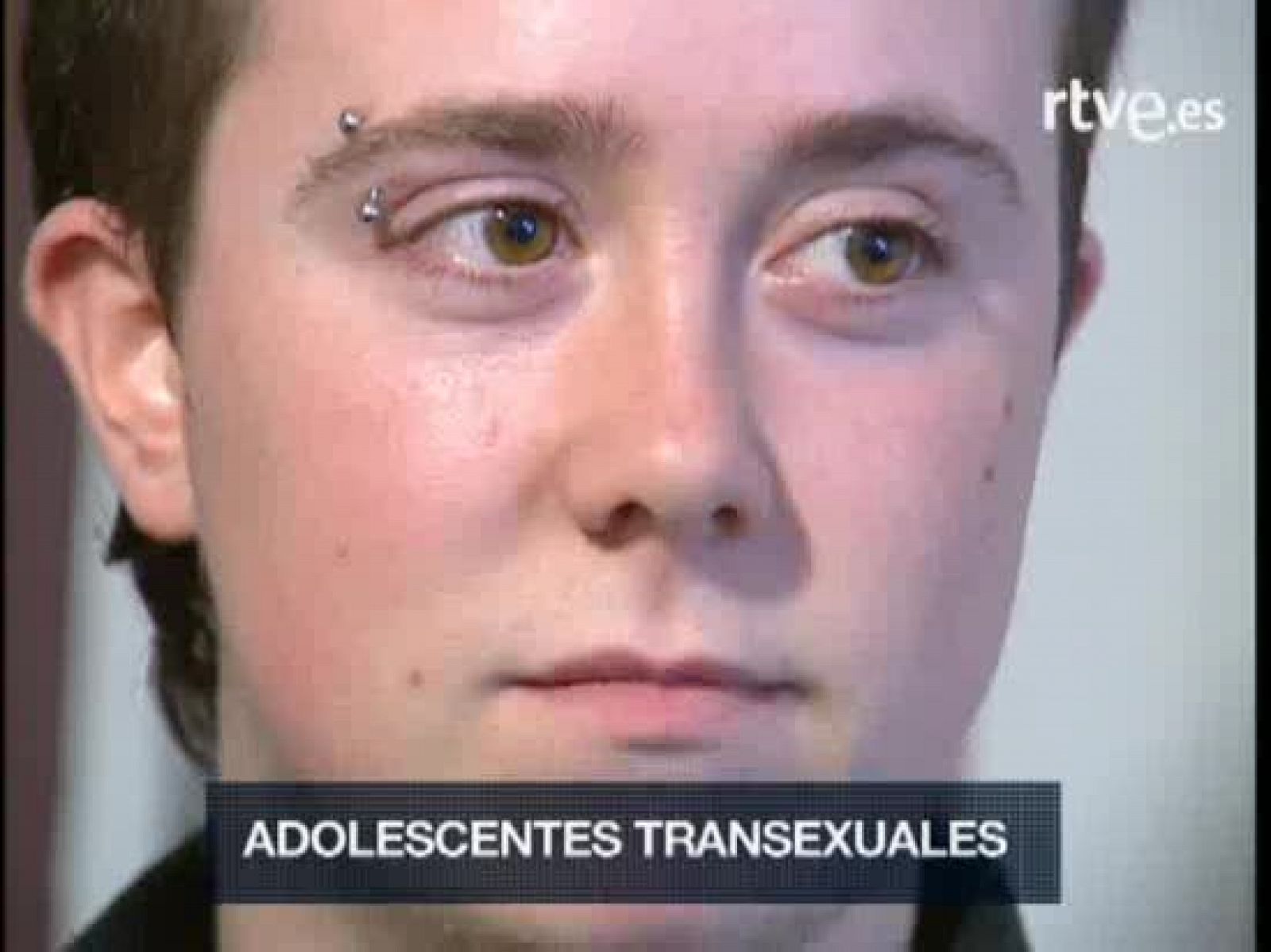 Transexualidad en la adolescencia