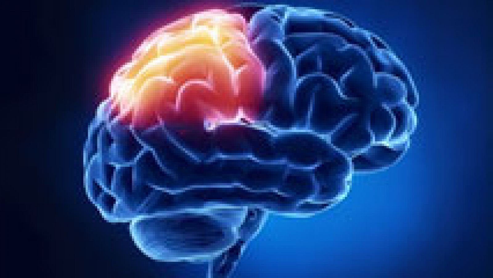 Saber Vivir - Miscelánea de enfermedades - Ictus cerebral 