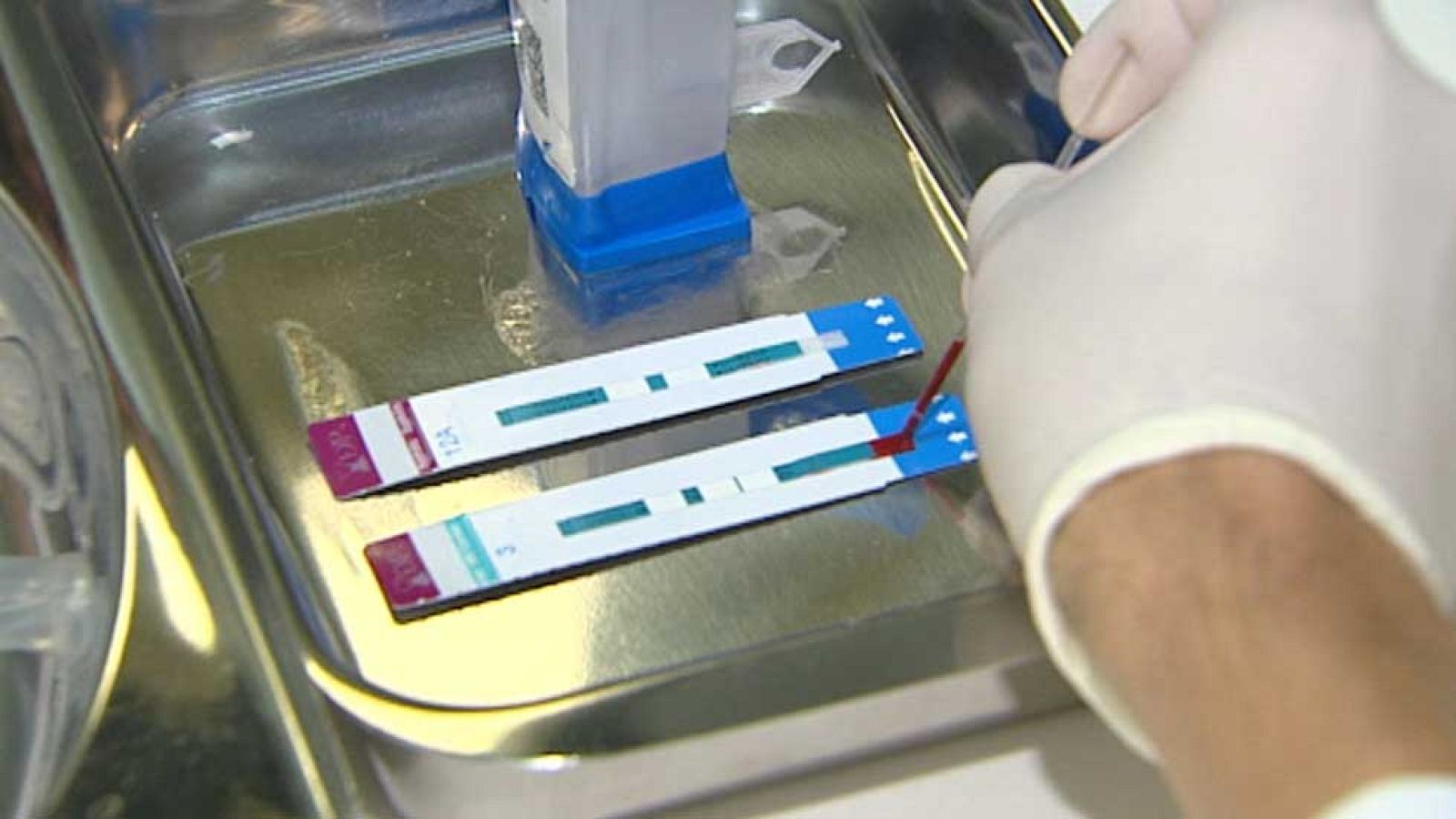 Nueva prueba para detectar el virus del Sida