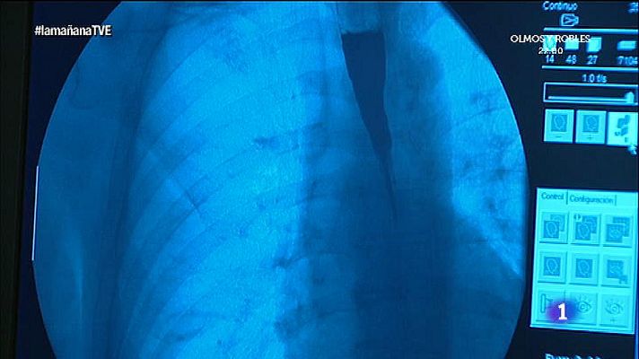 La mañana - Saber vivir - ¿Problemas estomacales?