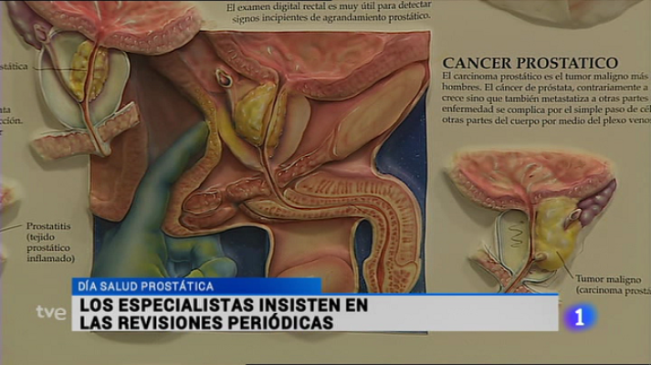 Informativo Telerioja - Informativo Telerioja - 15/09/15