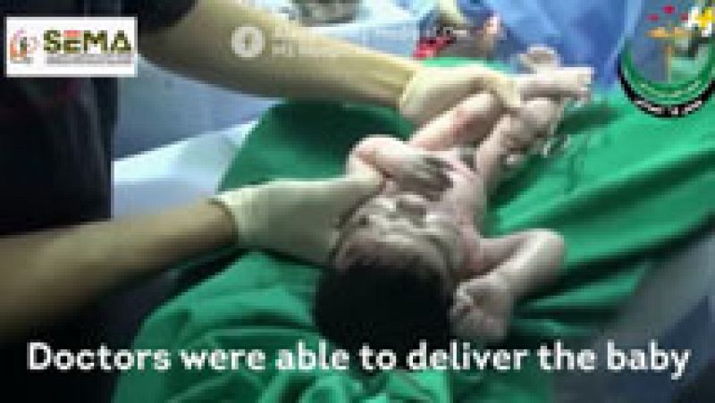 Una cesárea de emegencia a una mujer siria logra salvar a la recién nacida de heridas de metralla