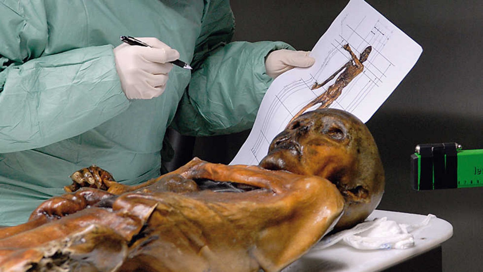 Documenta2 - La autopsia del hombre de los hielos