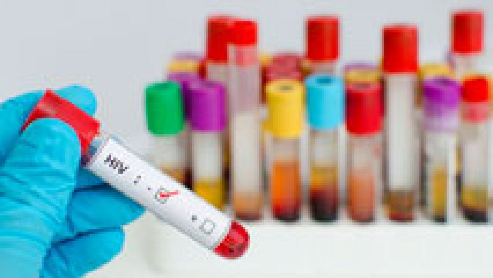 Telediario 1: España inicia primer ensayo mundial con sangre cordón umbilical para erradicar VIH en pacientes oncohematológicos | RTVE Play