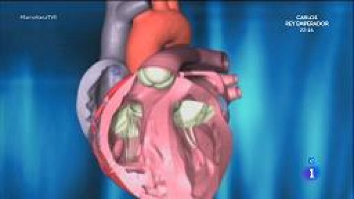 Hablamos de válvulas cardiacas