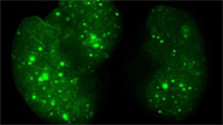 Un estudio identifica los mecanismos de la metástasis