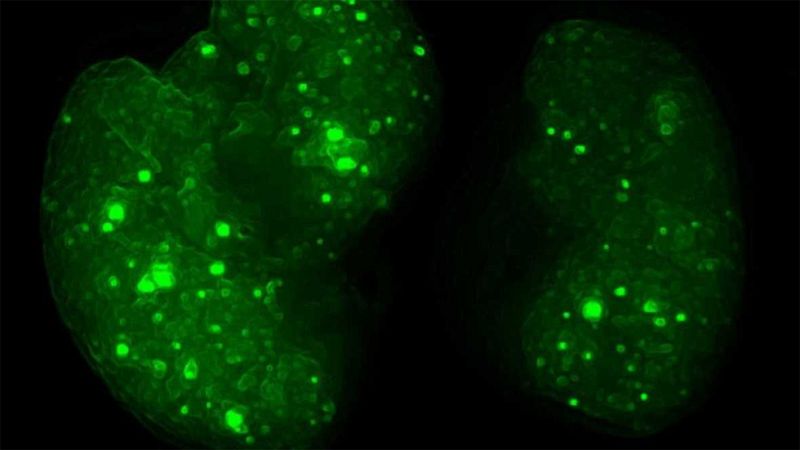 Impedir la metástasis es uno de los grandes retos a los que se enfrenta la lucha contra el cáncer. Científicos del Centro Nacional de Investigaciones Oncológicas y de la Universidad de Cornell en Nueva York han desvelado por primera vez el mecanismo 