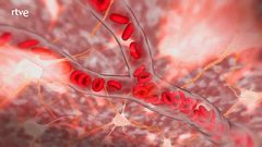 Esto es vida- ¿Qué sucede en el cerebro cuando tienes un ictus?