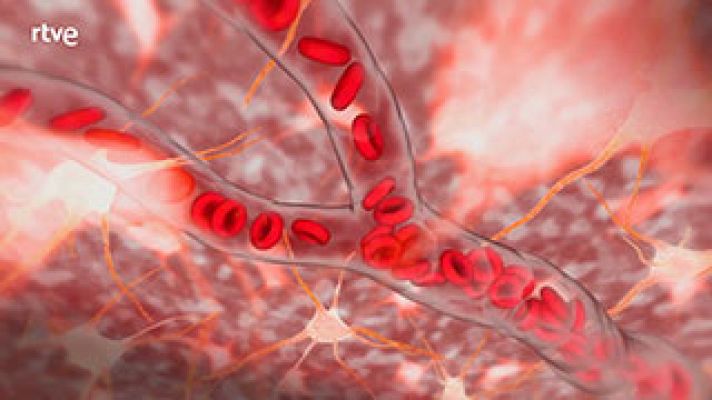  - ¿Qué sucede en el cerebro cuando tienes un ictus?