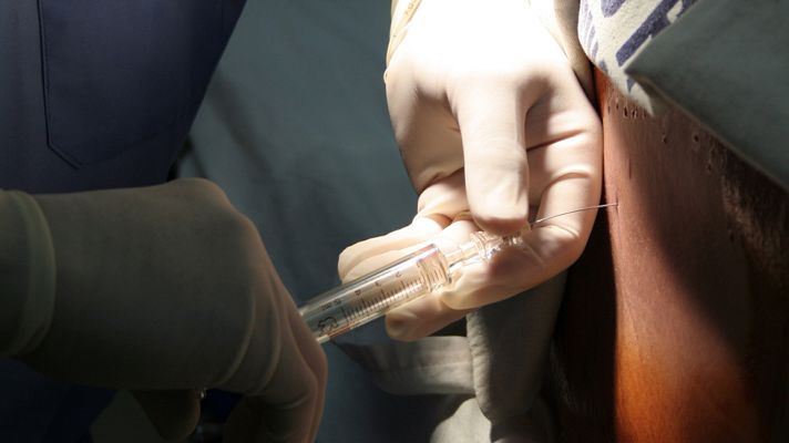 Telediario 1 - Una punción lumbar permitirá el diagnóstico precoz de tumores cerebrales