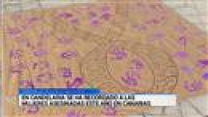 Telecanarias - Telecanarias - 22/11/2015