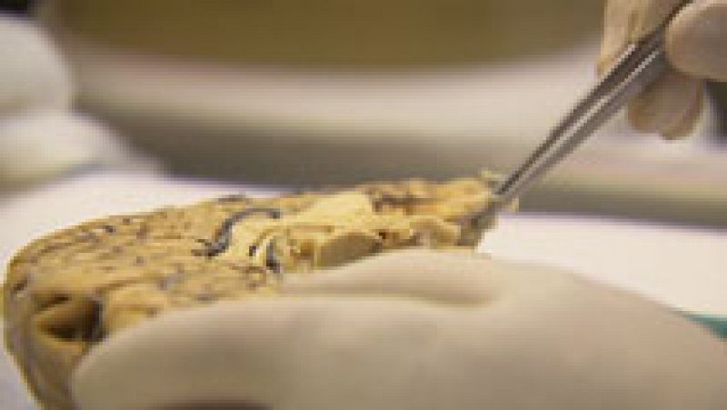 Científicos españoles descubren en cerebros de pacientes de Alzheimer que estaban infectados por hongos de su propia flora