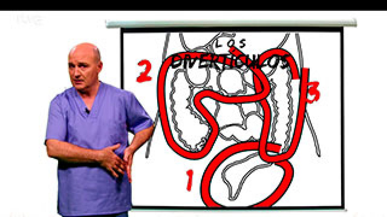  A partir de los 50 años es frecuente tener divertículos